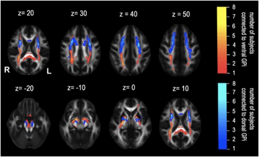 Investigador do INESC TEC publica artigo na revista científica NeuroImage