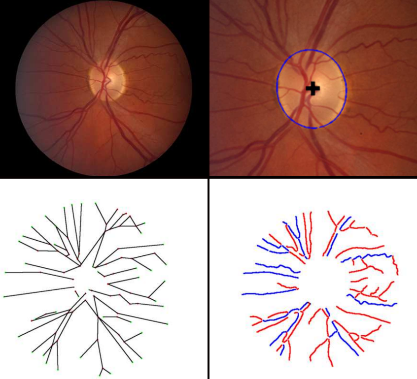 Artigo sobre aplicação RetinaCAD ganha prémio de melhor poster