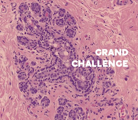 INESC TEC conquista 2º lugar no Grand Challenge in Digital Pathology