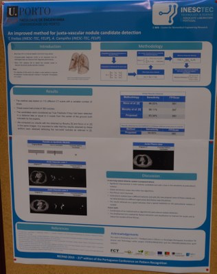 Artigo científico INESC TEC na área da Engenharia Biomédica nomeado para Best Paper Award