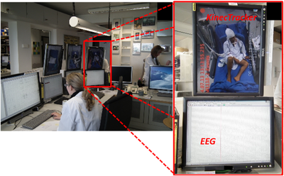 1º sistema de vídeo-3D do mundo para ajudar doentes epiléticos criado no INESC TEC