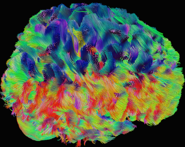 InSignals Neurotech é o nome da nova spin-off do INESC TEC